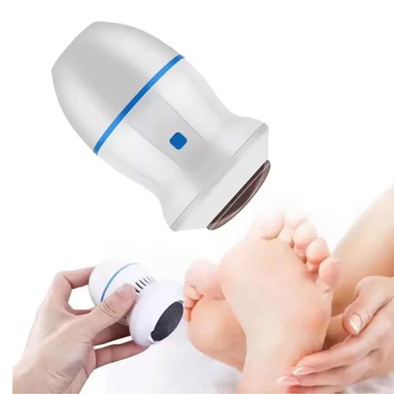 Rechargeable Pedicure Tool with Gentle & Powerful Exfoliation-Back Callus Remover with Built-In Vacuum Electric Foot Grinder for Dead Skin, Cracked Heels & Calluses