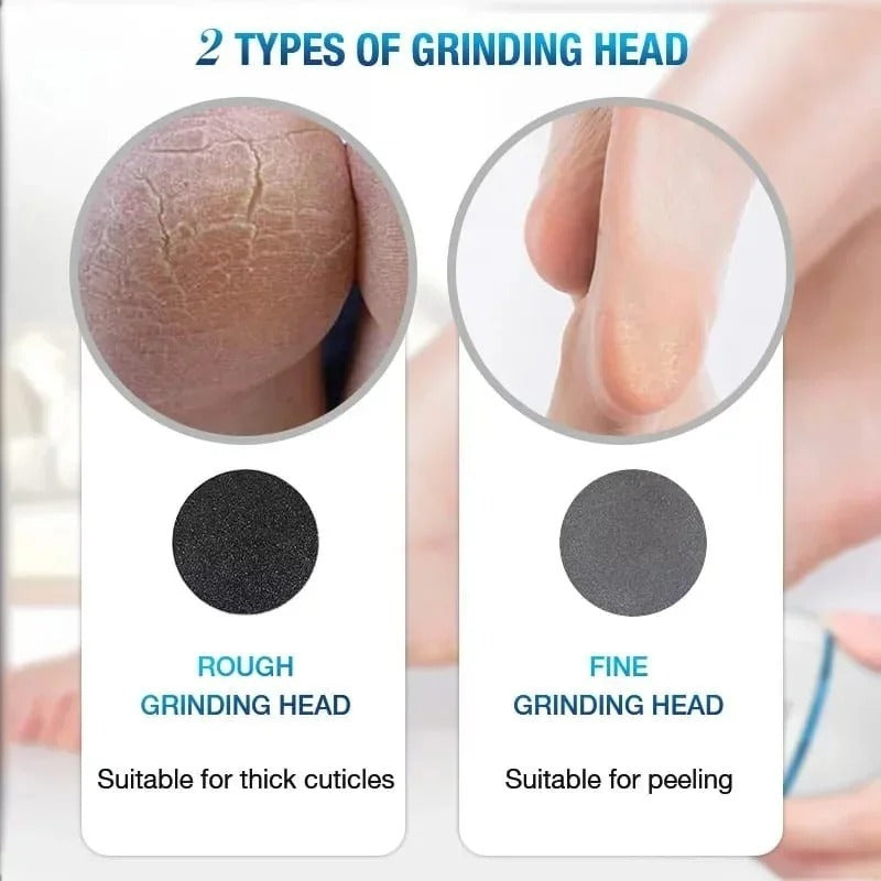 Rechargeable Pedicure Tool with Gentle & Powerful Exfoliation-Back Callus Remover with Built-In Vacuum Electric Foot Grinder for Dead Skin, Cracked Heels & Calluses